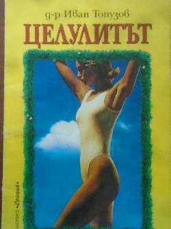 Целулитът, Иван Топузов